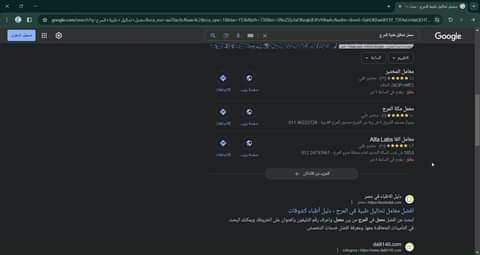الفيديو بيوضح ازاي بتظهر نتائج البحث على جوجل لما حد بيبحث عن اقرب وافضل معمل تح