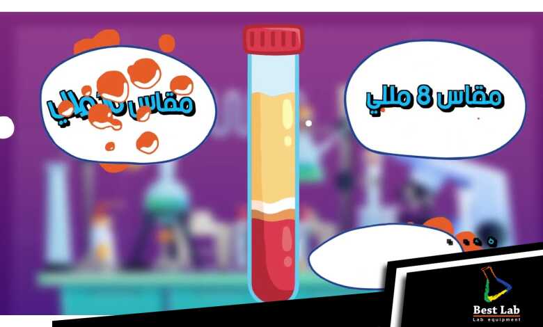 أفضل أنابيب البلازما الغنية بالصفائح في مصر!