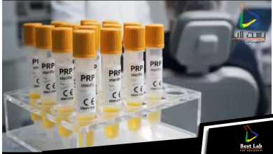 افضل أنابيب لتحضير البلازما PRP في بست لاب