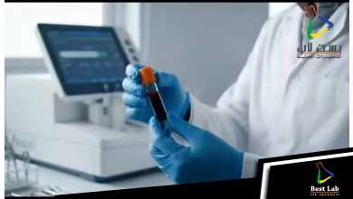 اول calibrator للــ Hb& HbA1c