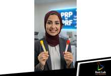 ايه الفرق بين الـ PRP & PRF
